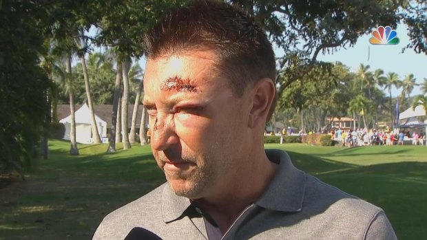 Robert Allenby after the incident in Hawaii.