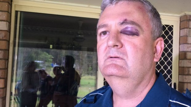 Paramedic Brad Johnson is one the victims of attacks, with 3300 assaults in the past year alone.