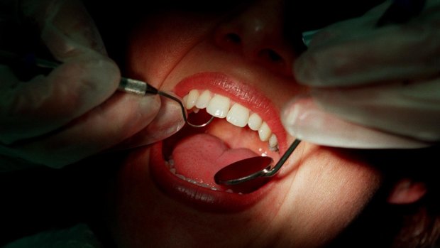 Early decay can be stopped and reversed before cavities form, the study says. 