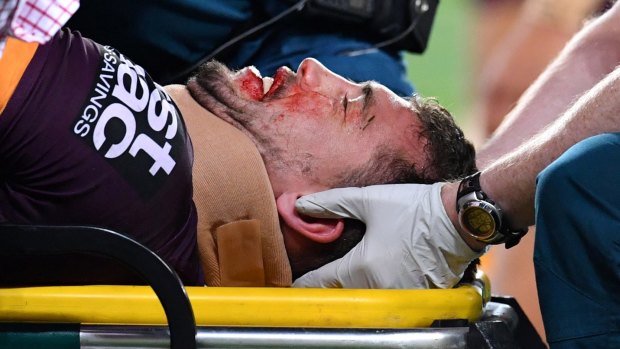 Knock out: Broncos winger Corey Oates was carried from the field on a stretcher last Friday night but might play against the Storm this week.