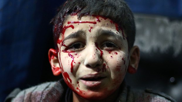 An injured Syrian child waits for treatment  in the rebel-held area of Douma, north-east of Damascus, on Monday. Rebels have been hacked and their military plans stolen.