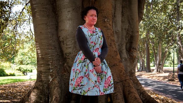 Carly Findlay, a Melbourne author and disability activist, says she's received two anonymous death threats online in the past fortnight. 