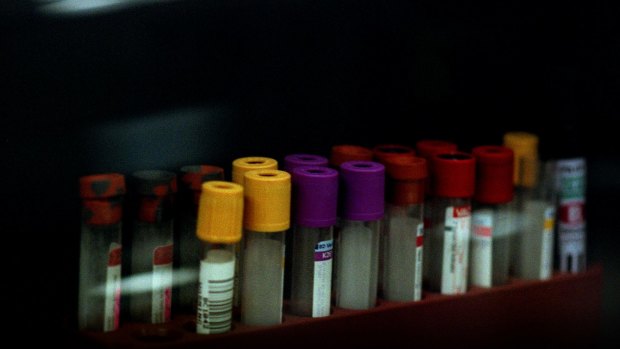 Melbourne Sexual Health Centre director Professor Christopher Fairley said usually testing for a sexually transmitted disease only required a self-collected sample of blood or urine.The Victorian Government is launching the first-ever  STI Testing Week.