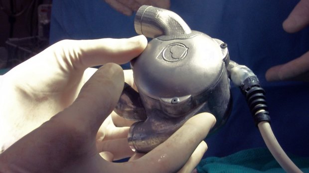 BiVACOR Inc's bionic heart, created in Houston, Texas, after critical early development in Brisbane.