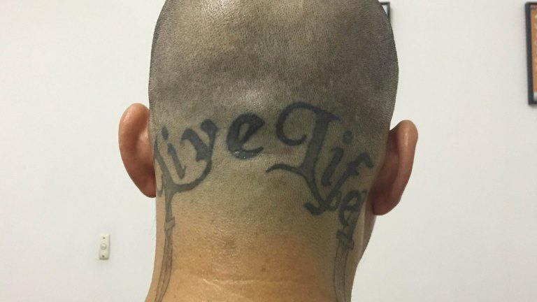 Boom In Tattoo Removal Businesses