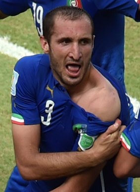 Italy's defender Giorgio Chiellini shows an apparent bitemark by Uruguay forward Luis Suarez