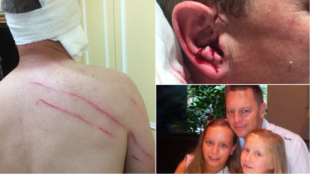Matthew Chenhall's injuries and, below right, with his daughters Holly and Amelia.