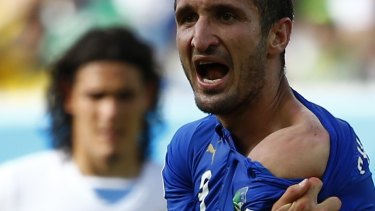 Italy's Giorgio Chiellini shows off bite marks on his shoulder.