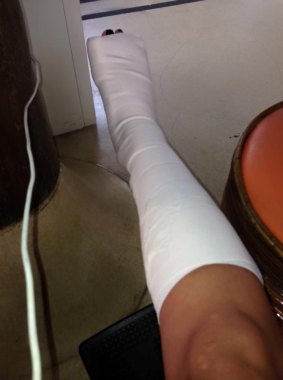 WIN reporter Jodi Lee posted a photo of her injured leg to Jetstar Australia's Facebook page.