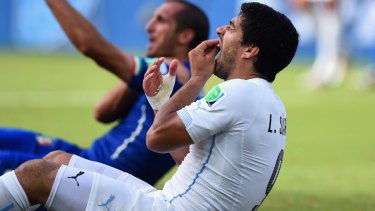 Luis Suarez says he fell face-first into Italian defender Giorgio Chiellini's shoulder.
