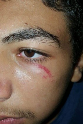 An image purportedly depicting a facial abraision suffered by a child at Nauru during a disturbance overnight.