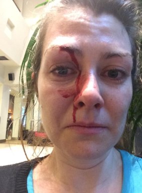 Erica Moloney, 32, who was allegedly punched in the face.