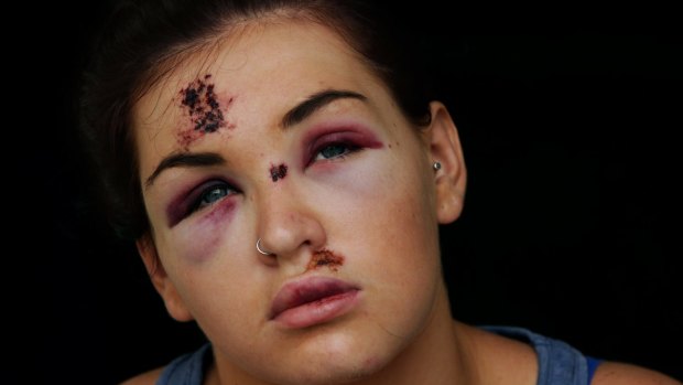 Brittany Merrick was bashed on Boxing Day.