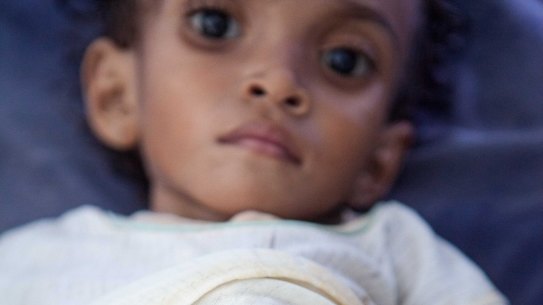 Children still remain malnourished in East Timor.