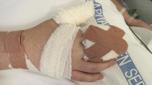 Isabelle had to undergo surgery on her hand after the attack
