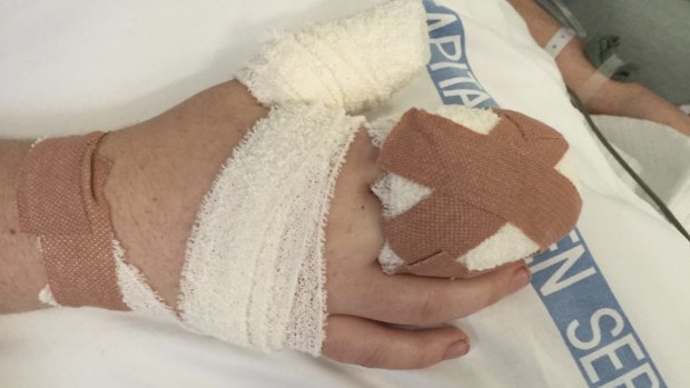 Isabelle Goldstraw's hand after the attack.