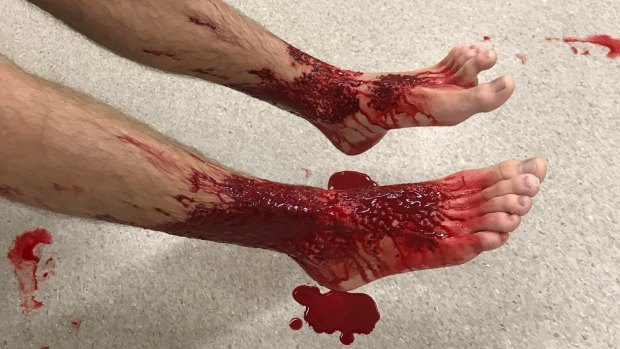 Sam Kanizay's feet after he emerged from the water at Brighton Beach.