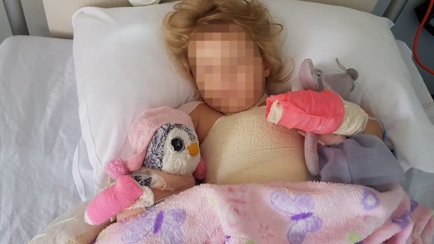 Three-year-old WA girl suffers horrific friction burns after treadmill  accident