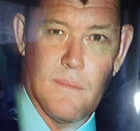 James Packer, sporting a black eye, being driven from his Bondi home.