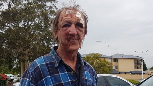 Police say three young men attacked 70-year-old David Goodhall. 