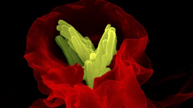 Coloured scanning electron micrograph of a macrophage white blood cell (red) engulfing a tuberculosis (Mycobacterium tuberculosis) bacterium (yellow).