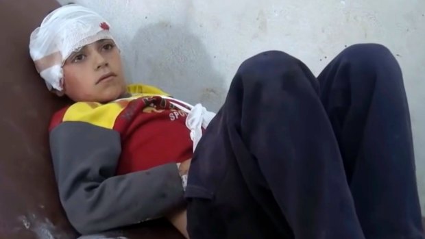 A child rests in hospital after being treated for wounds that independent observers say may have been the result of Syria-Russia coalition air strikes on the northern rebel-held village of Hass.