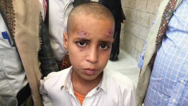 A boy from Yemen waits for brain surgery to remove bomb shrapnel from his brain in Yemen's forgotten war.