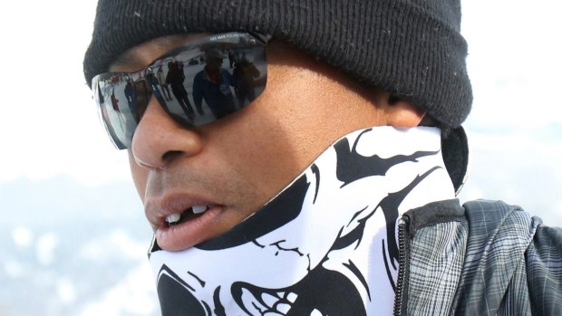 Disputed claims: Race organisers deny Tiger Woods' front tooth was knocked out by a camera.