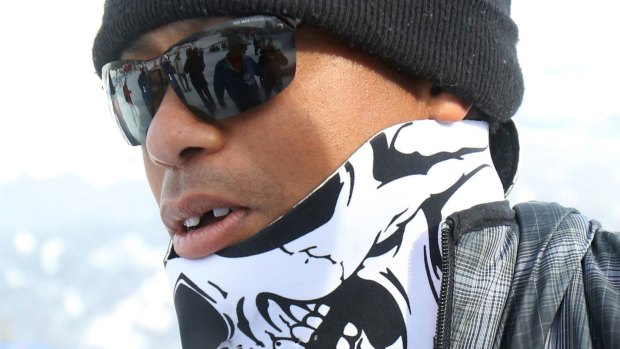 Tiger Woods says his front tooth was knocked out by a camera.