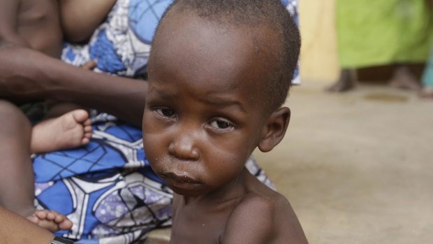 A malnourished child at a refugee camp in Nigeria. 