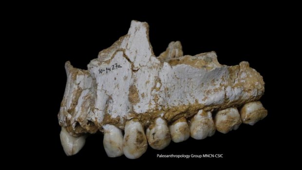A dental calculus deposit is visible on the rear molar of this Neanderthal upper jaw bone.This individual was eating poplar, a source of aspirin, and had also consumed moulded vegetation including Penicillium fungus, source of a natural antibiotic. 