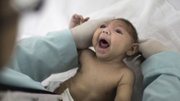 A baby with microcephaly, a defect linked to the Zika virus, in Brazil.