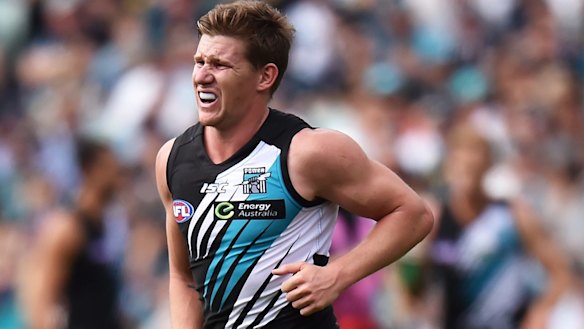 Matt White has a complete tear of his right pectoral muscle.