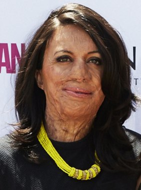 Turia Pitt. 