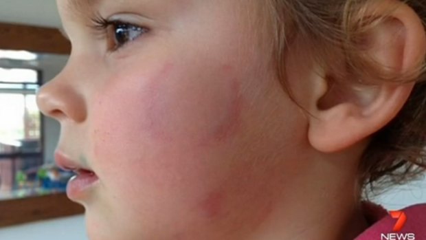 Duty of care: Creche standards are being questioned after the attack on Eva.