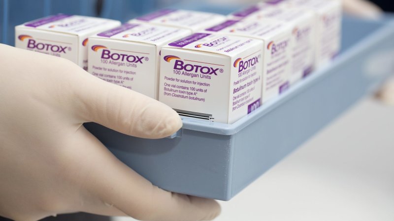 Botox effects picture