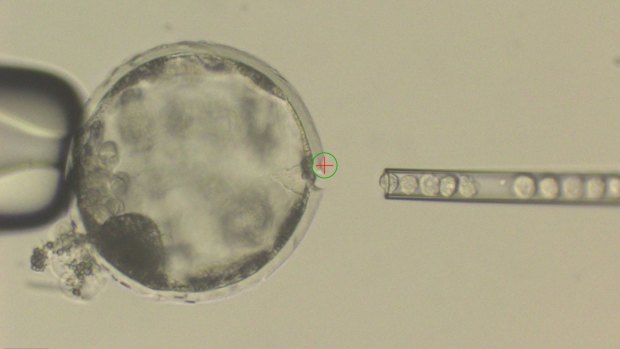Injection of human stem cells into a pig blastocyst, a precursor to the embryo. 