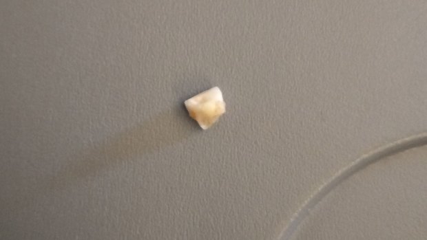 Melbourne man Bradley Button chomped down on what he believes was a chipped tooth - that wasn't his - on a flight from Wellington to Melbourne.