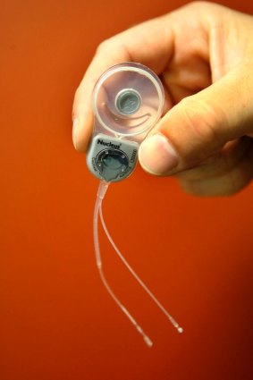 A Cochlear Implant 