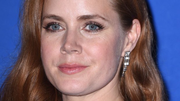 High price for looking beautiful:  Amy Adams at the 2015 Golden Globe Awards.