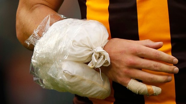 The ice pack applied to Luke Hodge's right arm in round one.
