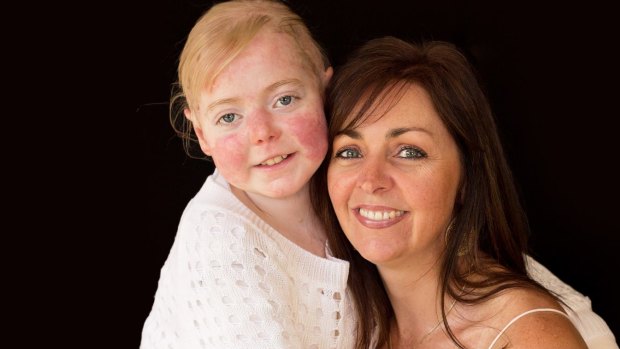 Eliza Baird with mum Simone.