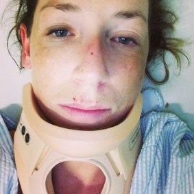 Cyclist Anne Marie Cooke was injured by another rider taking part in the notorious ''Hell Ride" along Beach Road, Mentone.