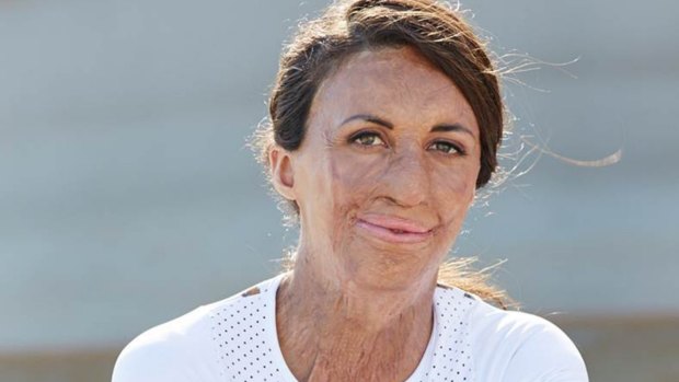 Turia Pitt cherishes her small-town upbringing in Mollymook.