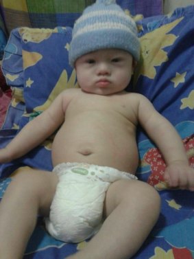 Gammy, who was abandoned in Thailand by his Australian parents, has Down's Syndrome.