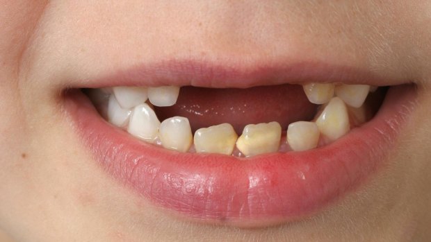 The review said it was pleased with the dental scheme for children.