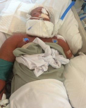 Gary Dowley lies in a Thai hospital after suffering a brain aneurysm.