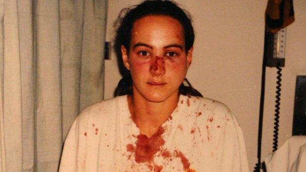  Corina Horvath in hospital after the police raid on her home in 1996. 