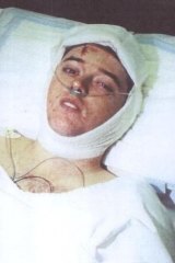 Benjamin Searl in hospital.
