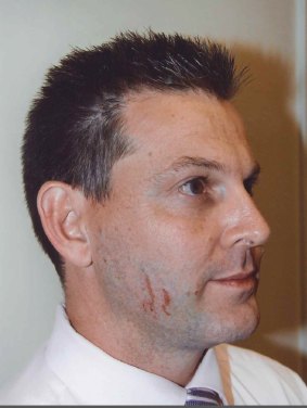 A police photograph of Gerard Baden-Clay, which  shows the scratches on the accused killer's face.